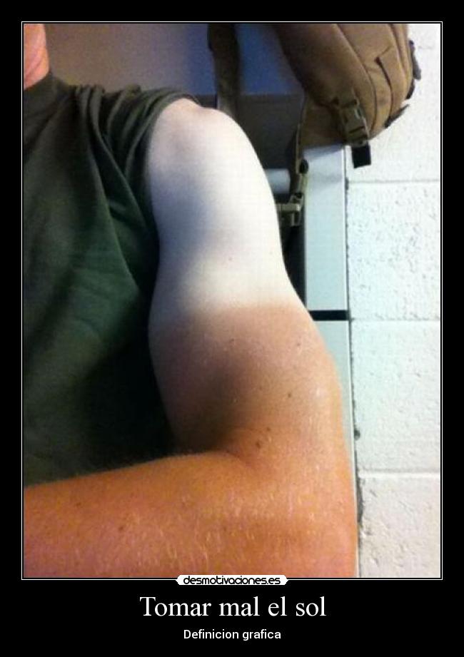 Tomar mal el sol - Definicion grafica