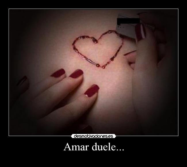 Amar duele... - 