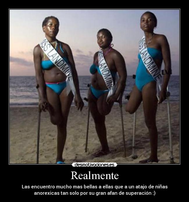 Realmente - Las encuentro mucho mas bellas a ellas que a un atajo de niñas
anorexicas tan solo por su gran afan de superación :)