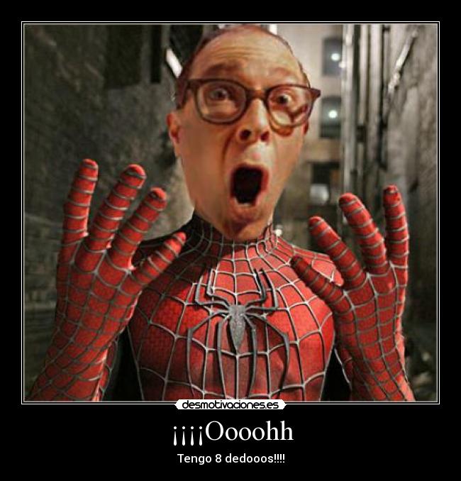 ¡¡¡¡Oooohh - Tengo 8 dedooos!!!!