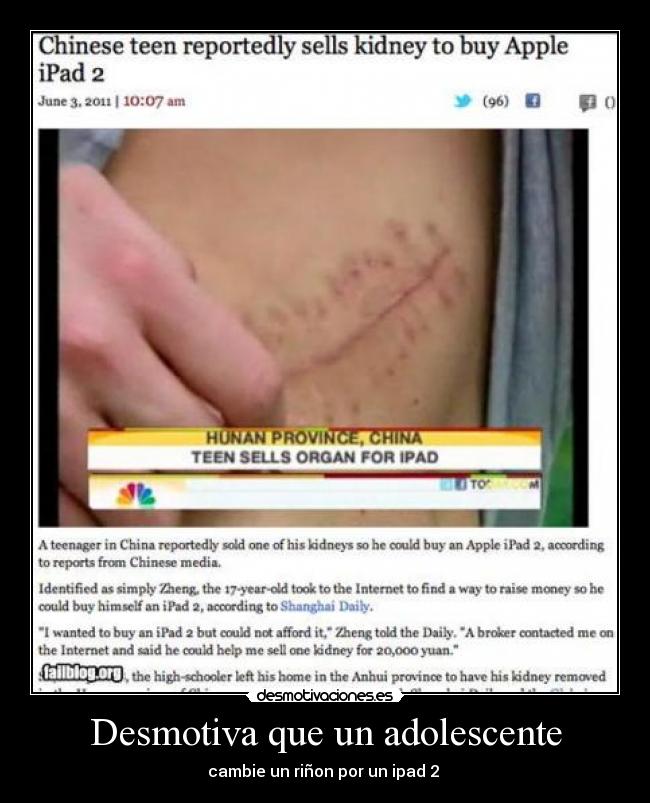 Desmotiva que un adolescente - cambie un riñon por un ipad 2