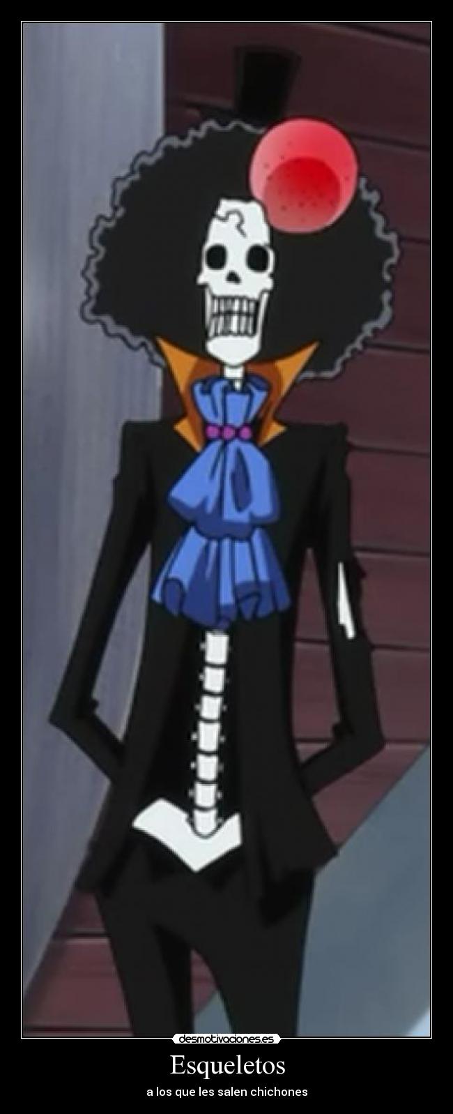 Esqueletos - 