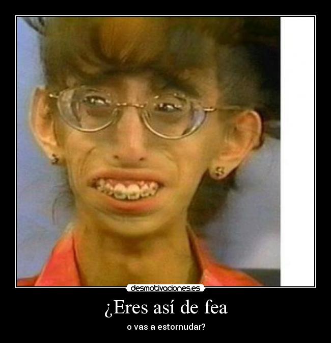 ¿Eres así de fea - o vas a estornudar?