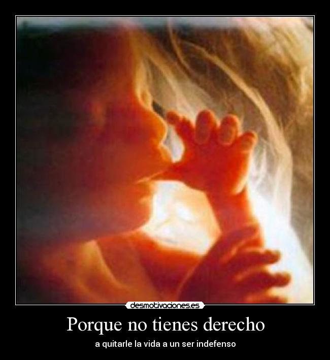 Porque no tienes derecho -