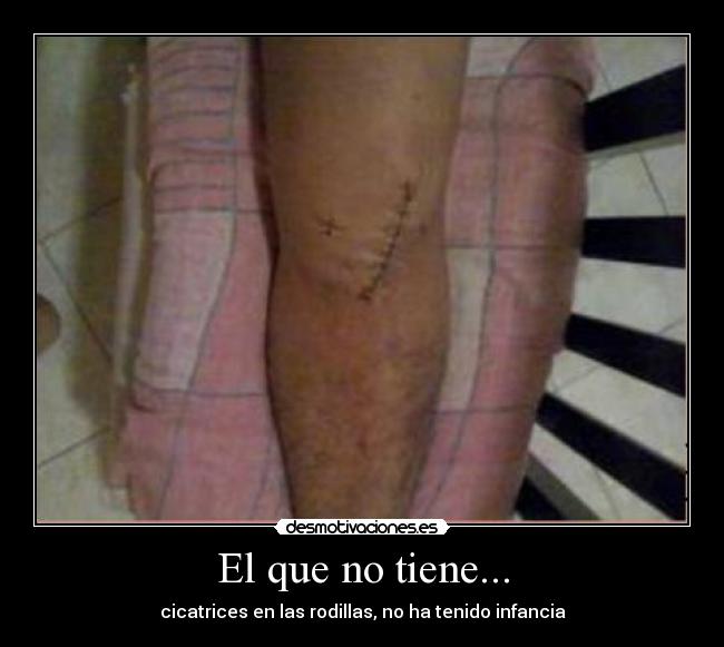 El que no tiene... - 