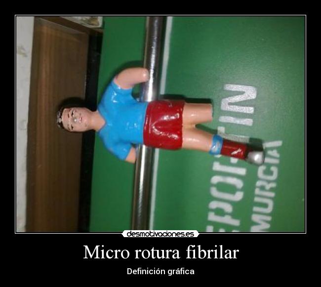 Micro rotura fibrilar - Definición gráfica