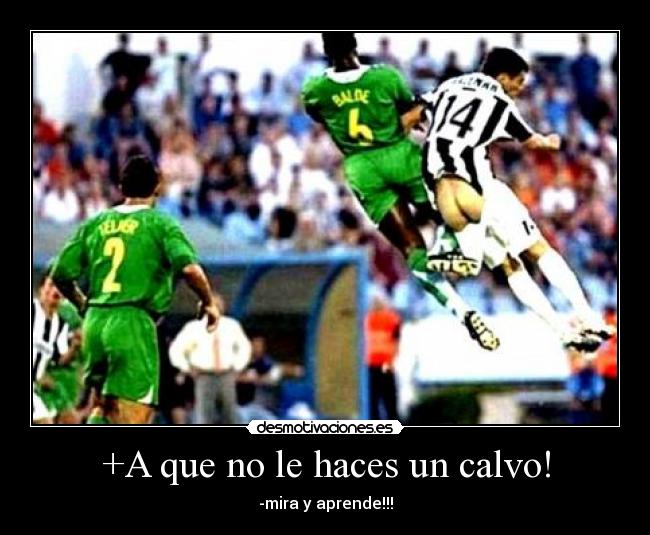 +A que no le haces un calvo! - 