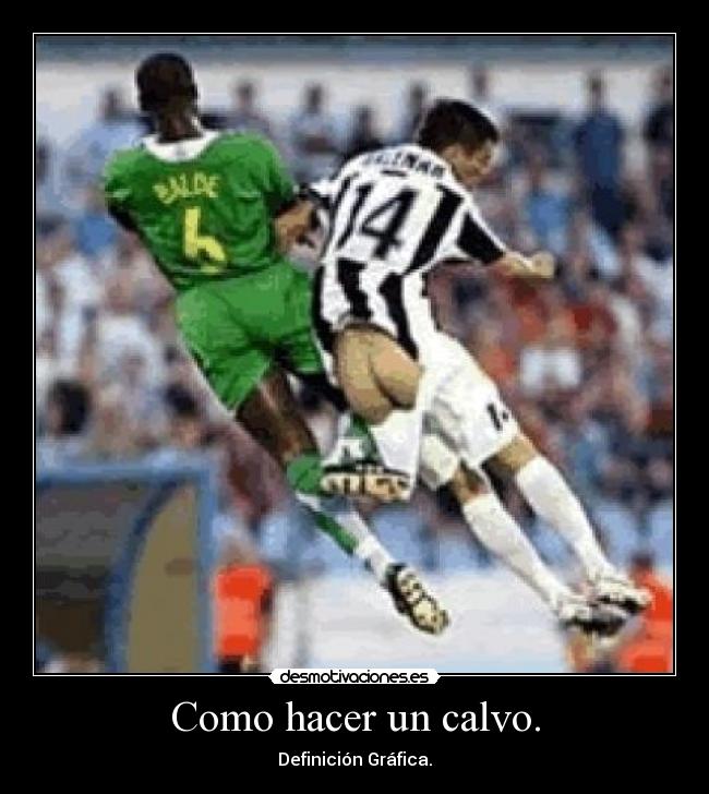 Como hacer un calvo. - Definición Gráfica.