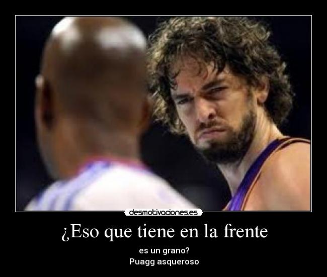 ¿Eso que tiene en la frente -