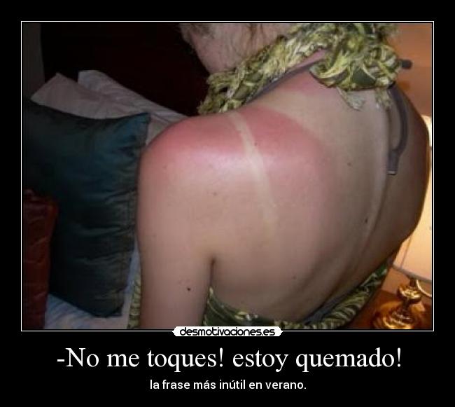 -No me toques! estoy quemado! - la frase más inútil en verano.