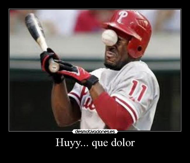 Huyy... que dolor -