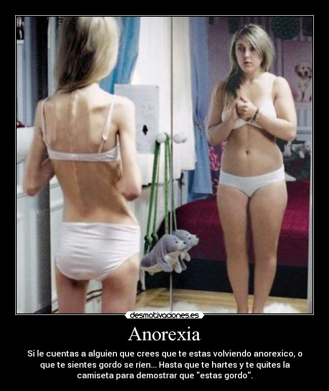 Anorexia - Si le cuentas a alguien que crees que te estas volviendo anorexico, o
que te sientes gordo se ríen... Hasta que te hartes y te quites la
camiseta para demostrar que estas gordo.