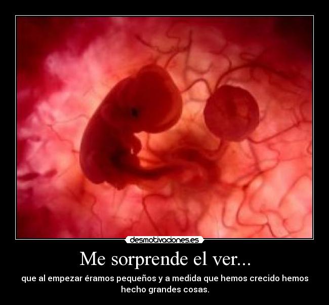 Me sorprende el ver... - 