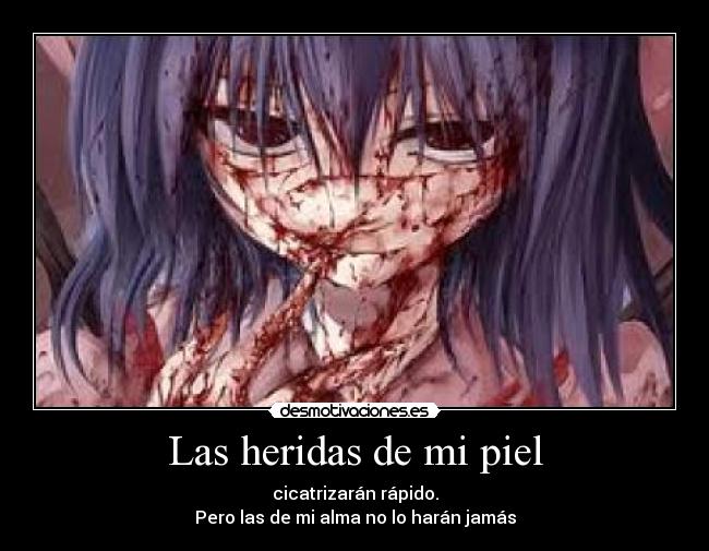 Las heridas de mi piel - cicatrizarán rápido.
Pero las de mi alma no lo harán jamás