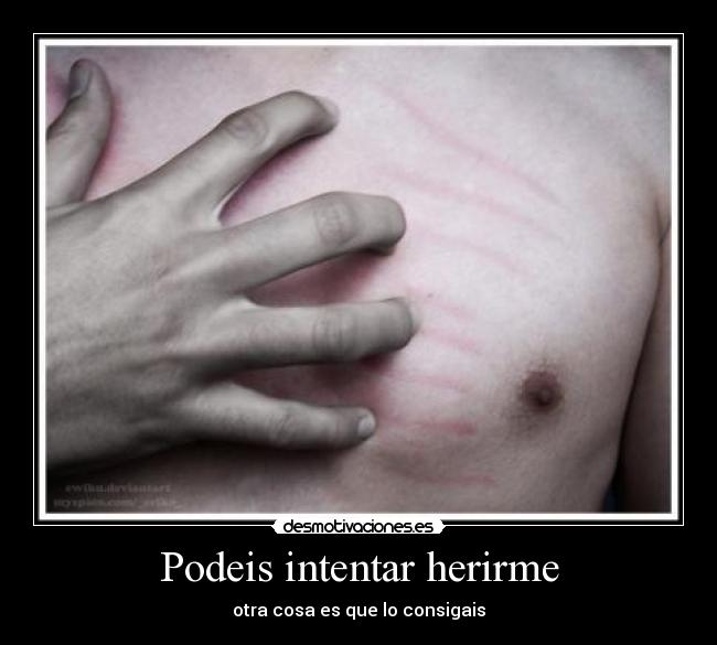 Podeis intentar herirme - otra cosa es que lo consigais