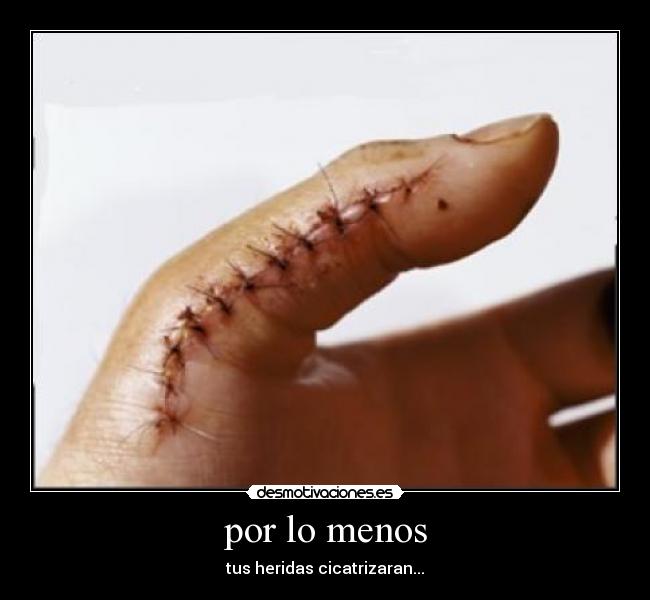 por lo menos - tus heridas cicatrizaran...