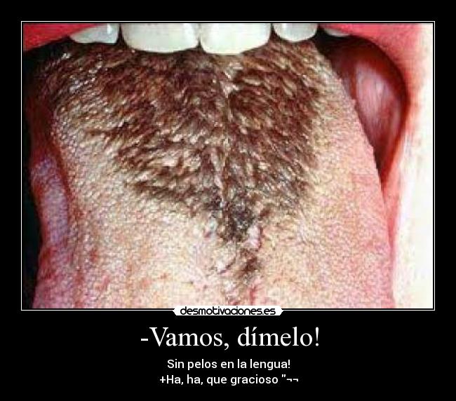 -Vamos, dímelo! - Sin pelos en la lengua!
+Ha, ha, que gracioso ¬¬