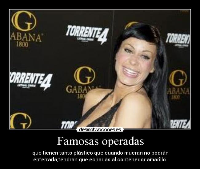 Famosas operadas - 