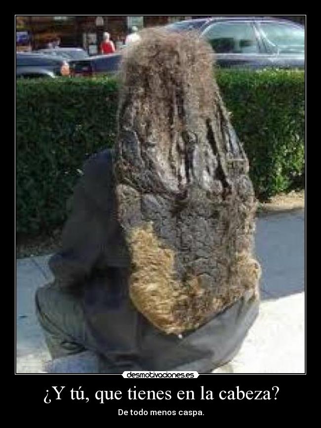 ¿Y tú, que tienes en la cabeza? - De todo menos caspa.