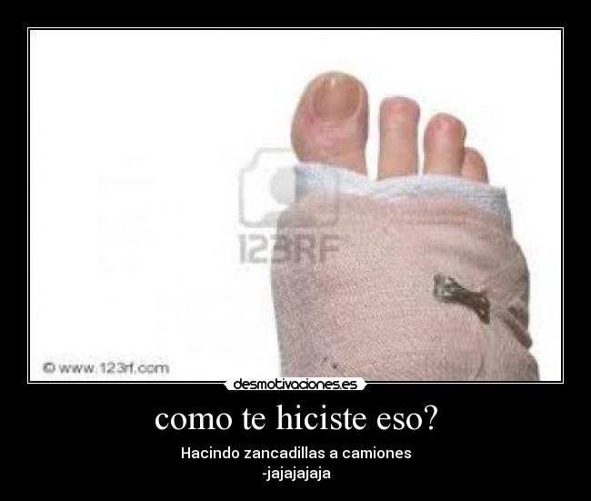 como te hiciste eso? - Hacindo zancadillas a camiones
-jajajajaja