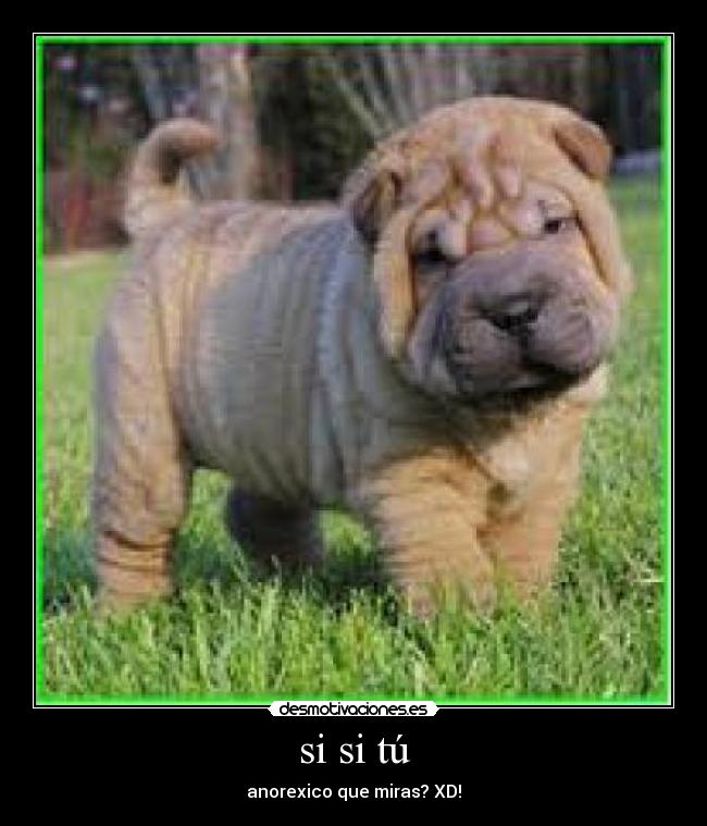 si si tú - anorexico que miras? XD!