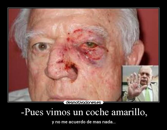 -Pues vimos un coche amarillo, - 