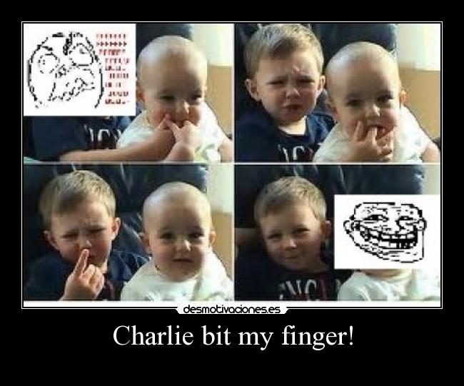 Charlie bit my finger! - 