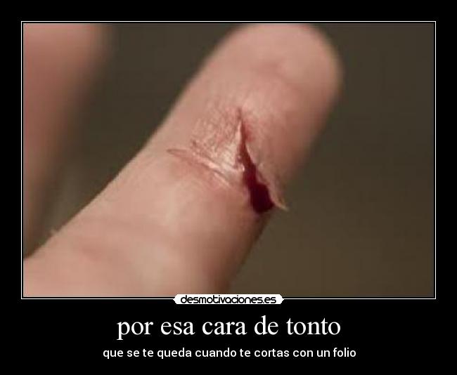 por esa cara de tonto - que se te queda cuando te cortas con un folio
