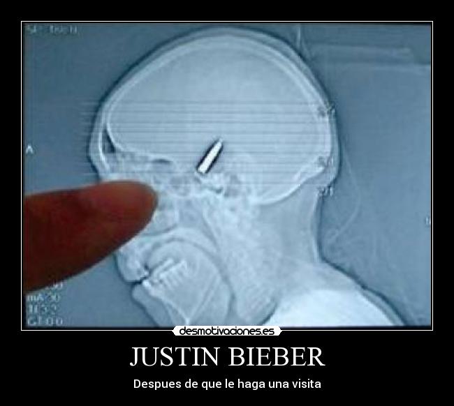 JUSTIN BIEBER - 