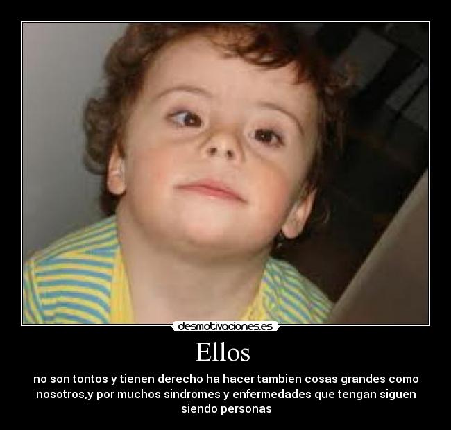 Ellos -