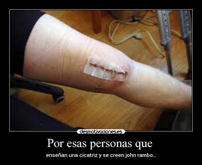 Por esas personas que  - 