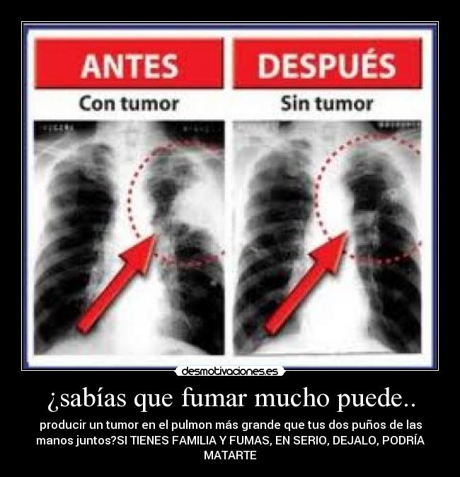 carteles dsvdbfvsef desmotivaciones