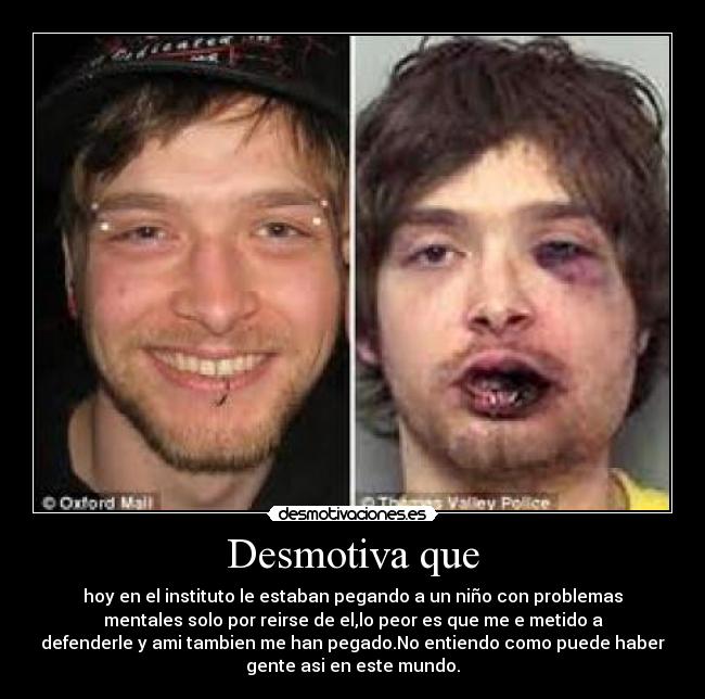 Desmotiva que - hoy en el instituto le estaban pegando a un niño con problemas
mentales solo por reirse de el,lo peor es que me e metido a
defenderle y ami tambien me han pegado.No entiendo como puede haber
gente asi en este mundo.