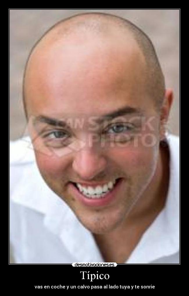 Típico - vas en coche y un calvo pasa al lado tuya y te sonrie