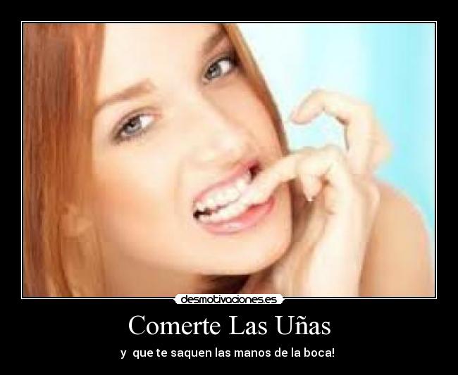 Comerte Las Uñas - 