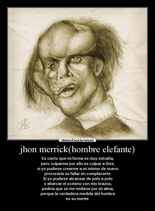 jhon merrick(hombre elefante) - 