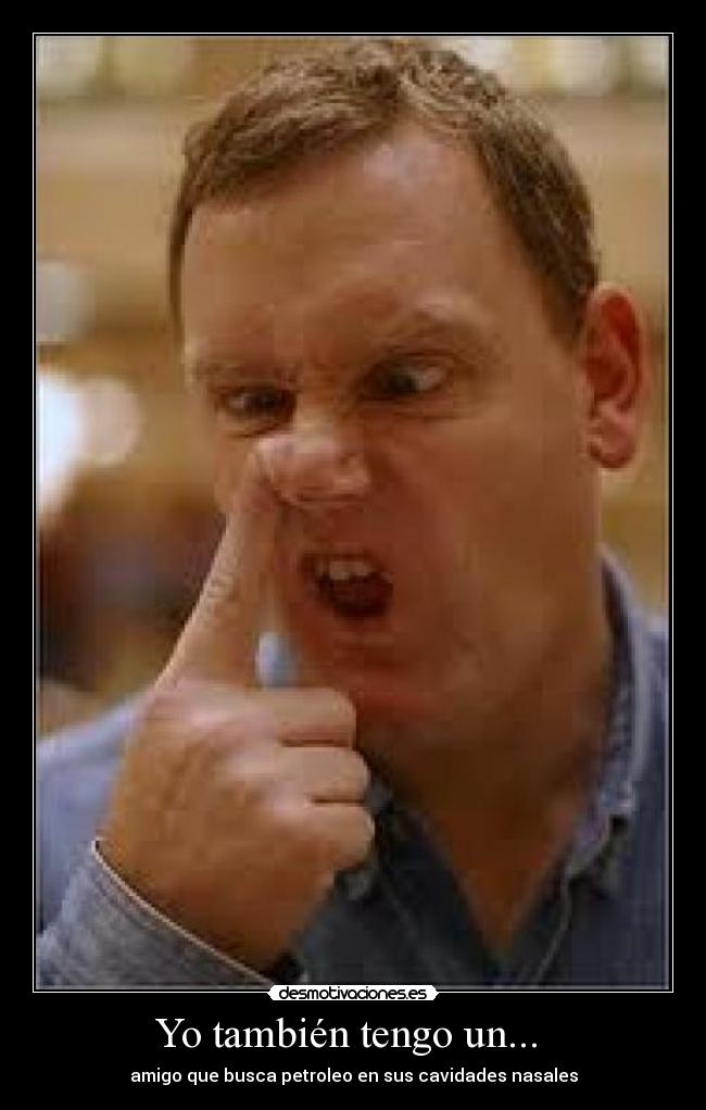 Yo también tengo un... -