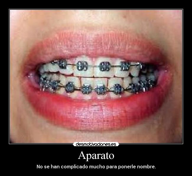 Aparato - No se han complicado mucho para ponerle nombre.