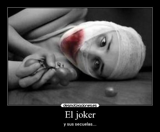 El joker - 