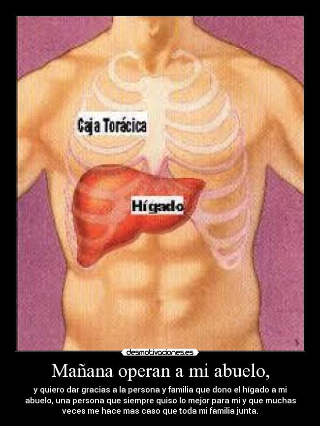 Mañana operan a mi abuelo, - 