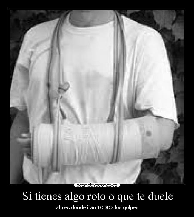 Si tienes algo roto o que te duele - ahí es donde irán TODOS los golpes