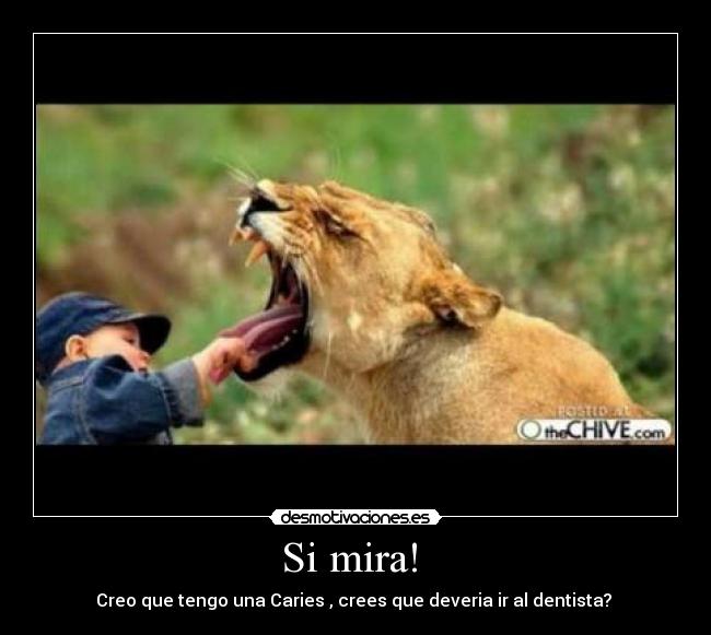 Si mira! - Creo que tengo una Caries , crees que deveria ir al dentista?
