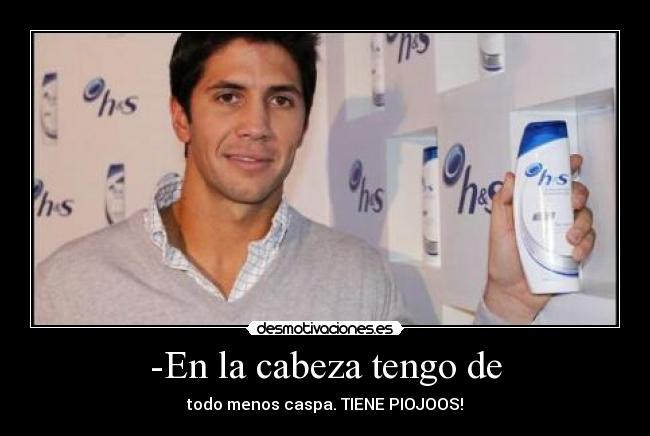 -En la cabeza tengo de - todo menos caspa. TIENE PIOJOOS!