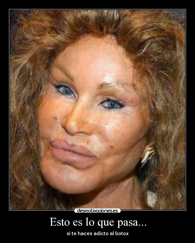 Esto es lo que pasa... - 