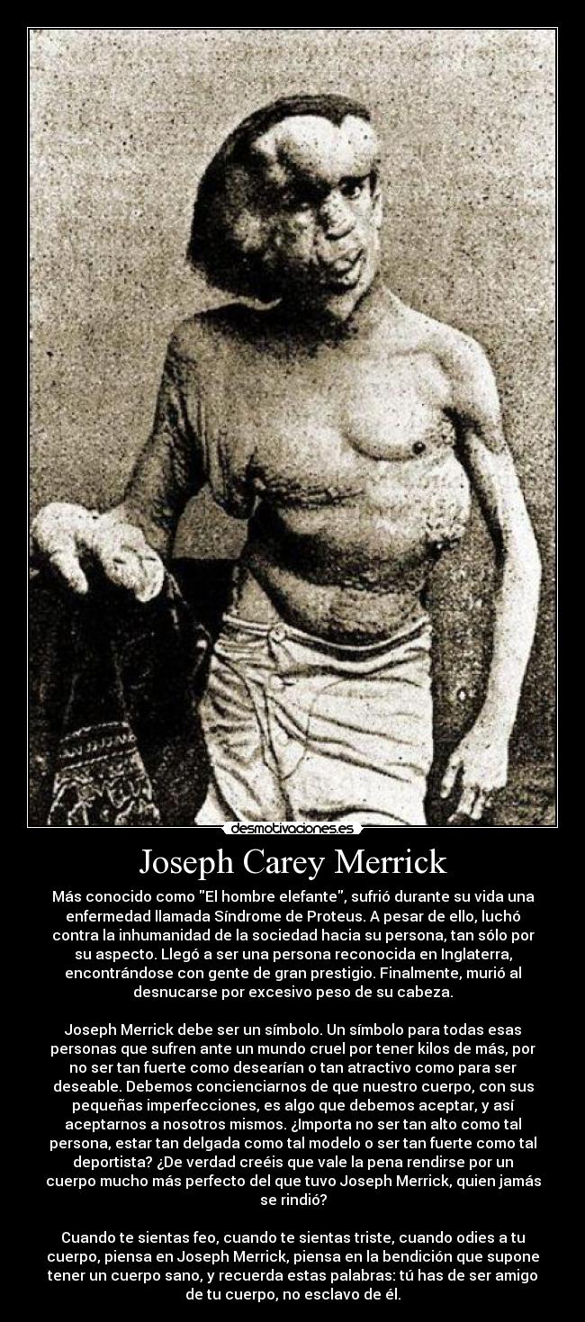 Joseph Carey Merrick - Más conocido como El hombre elefante, sufrió durante su vida una
enfermedad llamada Síndrome de Proteus. A pesar de ello, luchó
contra la inhumanidad de la sociedad hacia su persona, tan sólo por
su aspecto. Llegó a ser una persona reconocida en Inglaterra,
encontrándose con gente de gran prestigio. Finalmente, murió al
desnucarse por excesivo peso de su cabeza.

Joseph Merrick debe ser un símbolo. Un símbolo para todas esas
personas que sufren ante un mundo cruel por tener kilos de más, por
no ser tan fuerte como desearían o tan atractivo como para ser
deseable. Debemos concienciarnos de que nuestro cuerpo, con sus
pequeñas imperfecciones, es algo que debemos aceptar, y así
aceptarnos a nosotros mismos. ¿Importa no ser tan alto como tal
persona, estar tan delgada como tal modelo o ser tan fuerte como tal
deportista? ¿De verdad creéis que vale la pena rendirse por un
cuerpo mucho más perfecto del que tuvo Joseph Merrick, quien jamás
se rindió?

Cuando te sientas feo, cuando te sientas triste, cuando odies a tu
cuerpo, piensa en Joseph Merrick, piensa en la bendición que supone
tener un cuerpo sano, y recuerda estas palabras: tú has de ser amigo
de tu cuerpo, no esclavo de él.