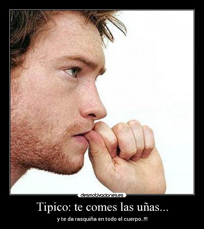 Tipico: te comes las uñas... - y te da rasquiña en todo el cuerpo..!!!