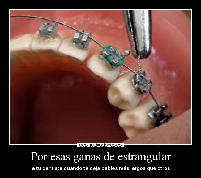 Por esas ganas de estrangular -