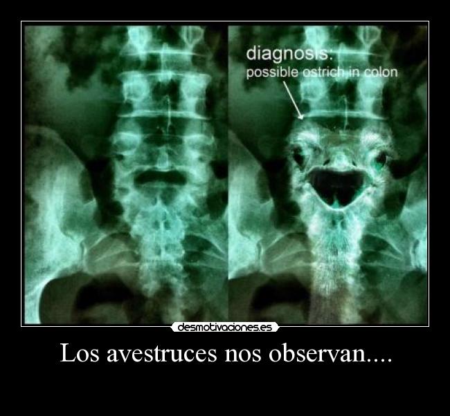 Los avestruces nos observan.... -