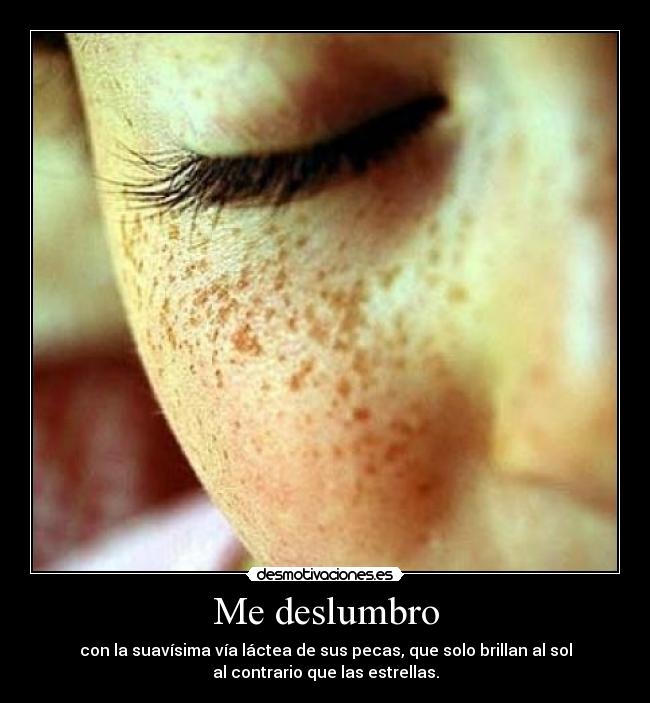 Me deslumbro - con la suavísima vía láctea de sus pecas, que solo brillan al sol
al contrario que las estrellas.