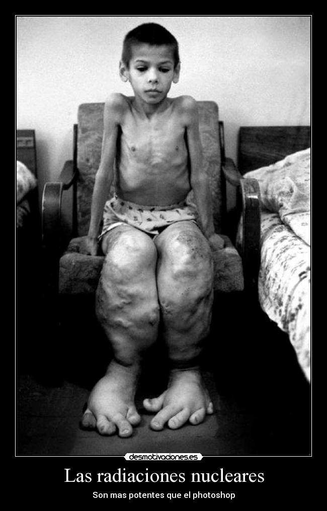 Las radiaciones nucleares - Son mas potentes que el photoshop